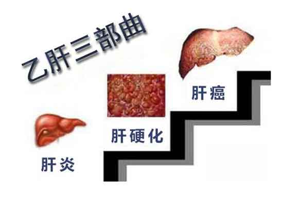 郑州哪家医院看肝病好
