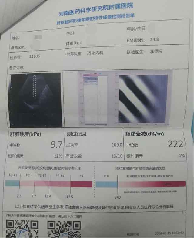 肝硬化医院|郑州那个医院治疗肝硬化好