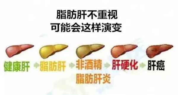 周口市正规病医院肝病科预约挂号