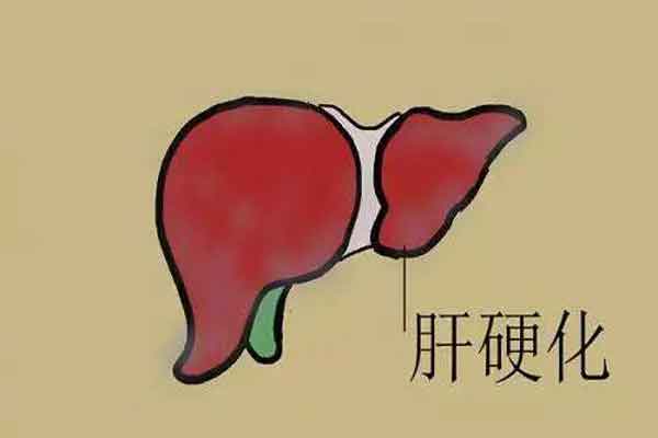 河南省医哪个医生看肝硬化比较好