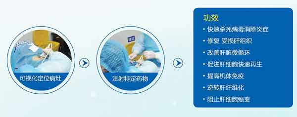 河南省医哪个医生看肝硬化比较好