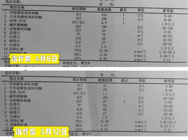 郑州市哪家医院看大三阳比较好