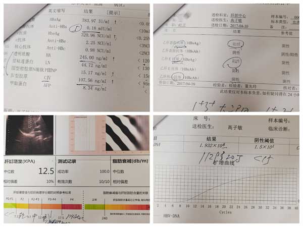 河南省哪个医院治乙肝效果好