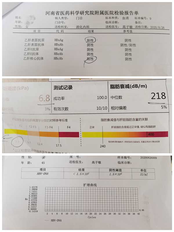 河南省哪个医院治乙肝效果好