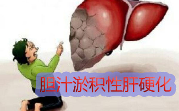 郑州那家肝硬化医院比较好