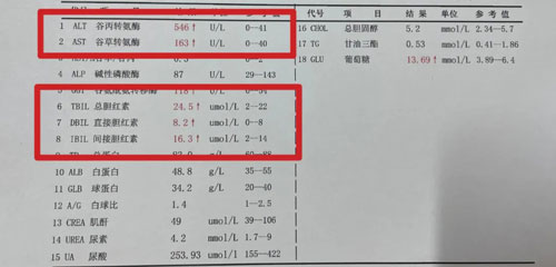 常怀利:乙肝活动期是治疗的关键时期,不要错过这个时机
